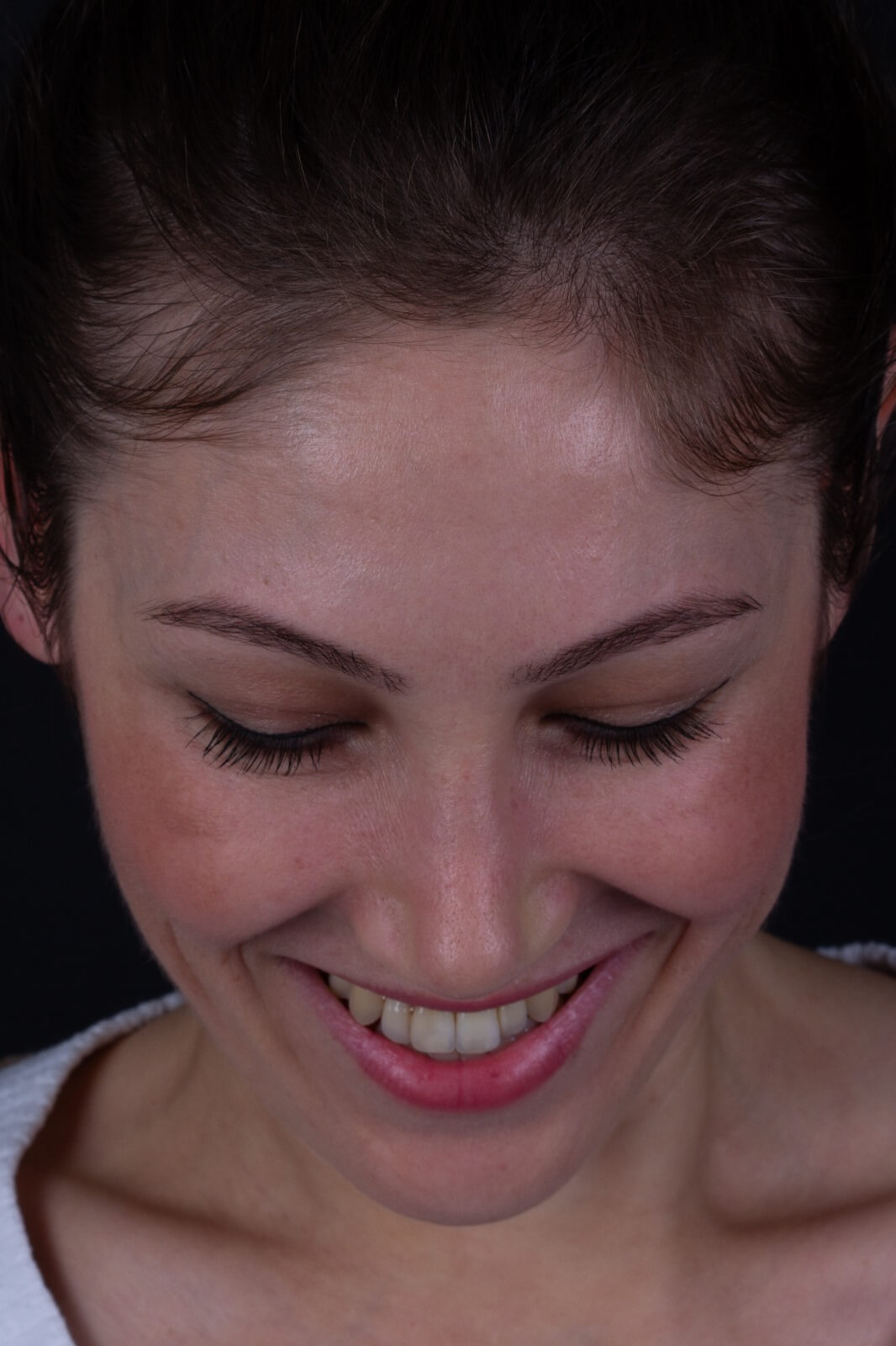 Saat 12 pozisyonu ve dişler okluzyonda gülerken